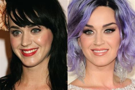 Katy Perry Before And After Plastic Surgery Boobs Face My XXX Hot Girl