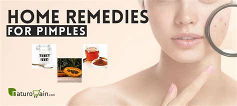 6 Home Remedies For Pimples Get Rid Of Acne Naturally And Quickly