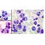 Figure 8 From Plasma Cell Morphology In Multiple Myeloma And Related 