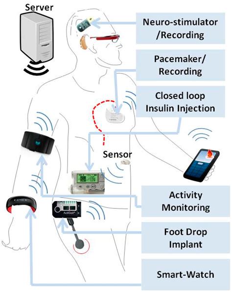 Sensors Free Full Text Wireless Integrated Biosensors For Point Of