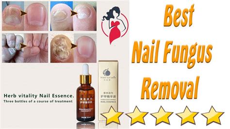 Best Nail Fungus Removal Reviews 2018 Youtube