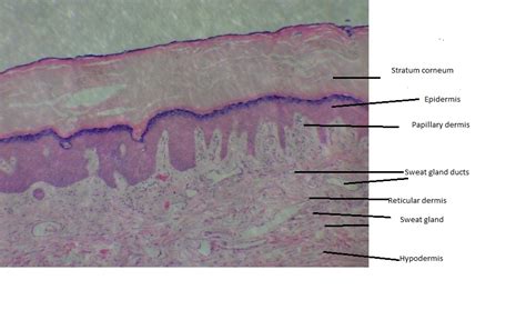 Solved Label The Epidermis Dermal Layer And Sweat Gland Duct If