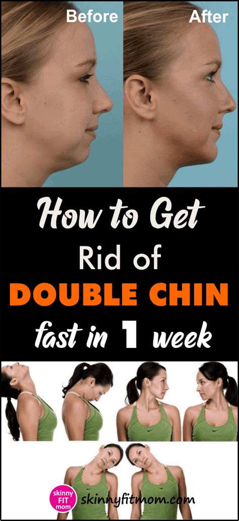 How To Get Rid Of Double Chin Fast Easy Teamore