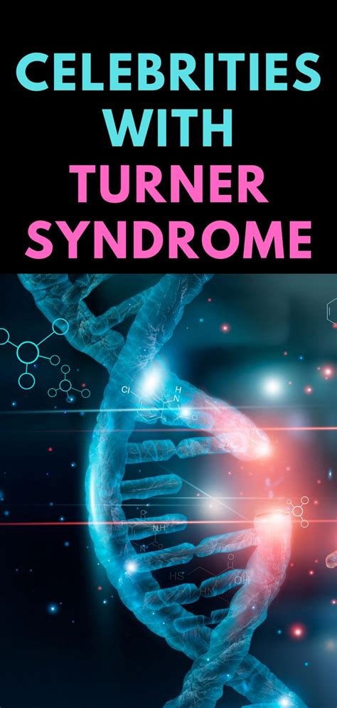 Celebrities With Turner Syndrome Turner Syndrome Syndrome Health Guide