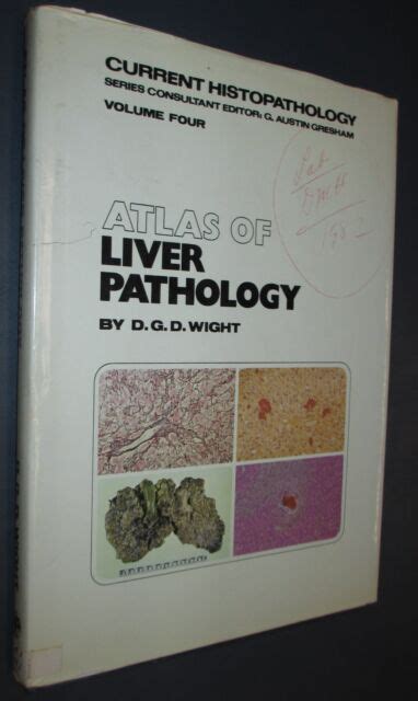 Atlas Of Liver Pathology 0 397 50 453 5 Hardcover Medical Text Book