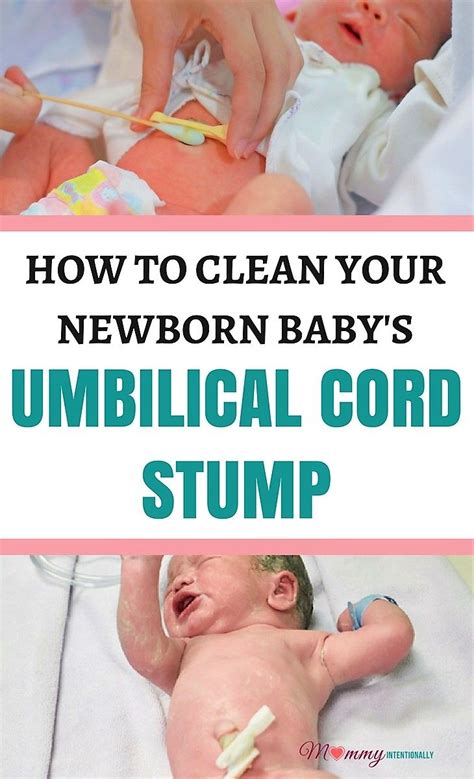 You should take extra care of the umbilical cord while giving a sponge bath and keep it dry always. Pin on Baby things