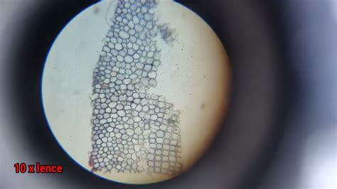Sclerenchyma Under Microscope