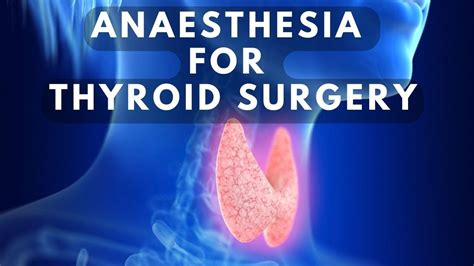 Anaesthesia For Thyroid Surgery Youtube