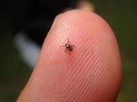 Meat Allergy Cases Linked To Tick Bites Growing In Connecticut Cdc