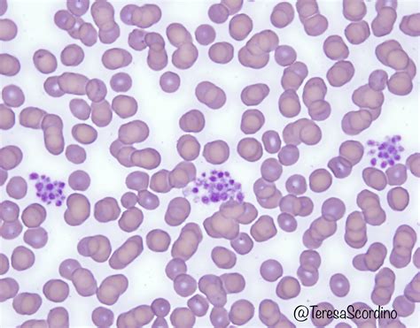 What Causes Platelet Clumping In Dogs