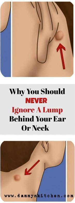 Vital Pieces Of Lumps On Neck Lump Behind Ear Skin