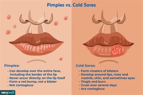 Top 7 Bump On Lip Not Cold Sore 2022