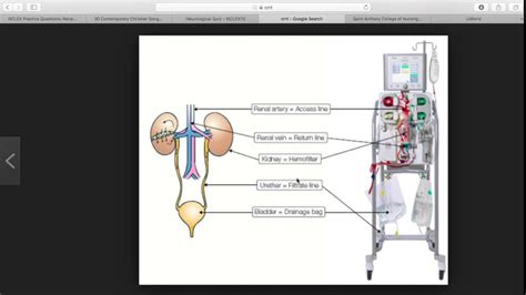 Continuous Renal Replacement Therapies CRRT YouTube