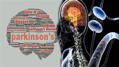 Parkinson Penyakit Apa Kenali Gejala Penyakit Parkinson Dan Penyebab