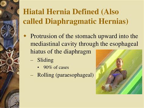 Ppt Diaphragm And Hiatus Hernia Powerpoint Presentation Free