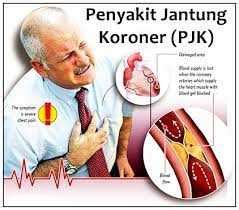 Ecg, treadmill, echokardiografi dan arteriorgrafi koroner (yang sering dikenal sebagai kateterisasi). Ketahui Penyebab dan Gejala Penyakit Jantung Koroner ...