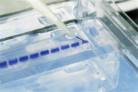 Samples Of Dna Being Loaded Onto An Agarose Gel Photograph By Klaus