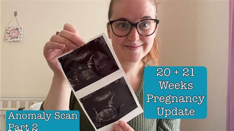 20 21 weeks pregnancy update anomaly scan part 2 symptoms lots of kicks youtube