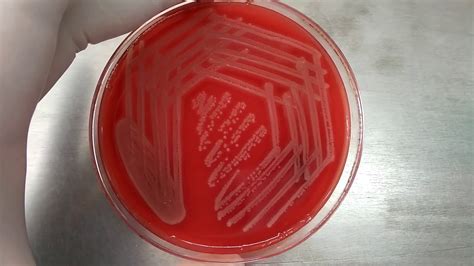 Staphylococcus Aureus On Blood Agar With Beta Hemolytic Colony Youtube