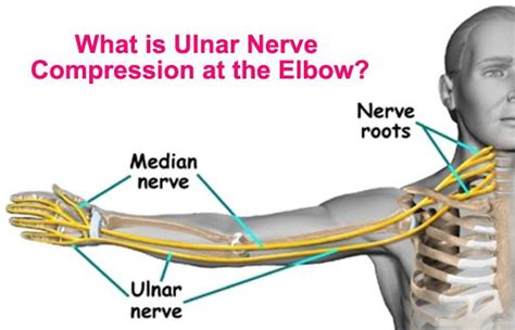 What Is Ulnar Nerve Compression At The Elbow Ulnar Nerve Ulnar