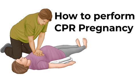 How Cpr Is Performed On A Pregnant Person