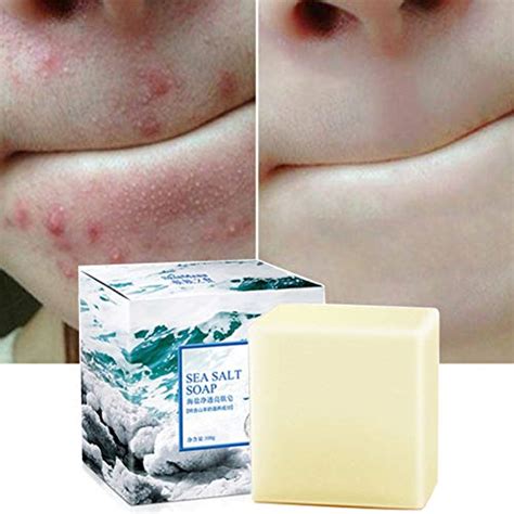 Best Acne Soap For Oily Skin Guide To Finding The Right Solution