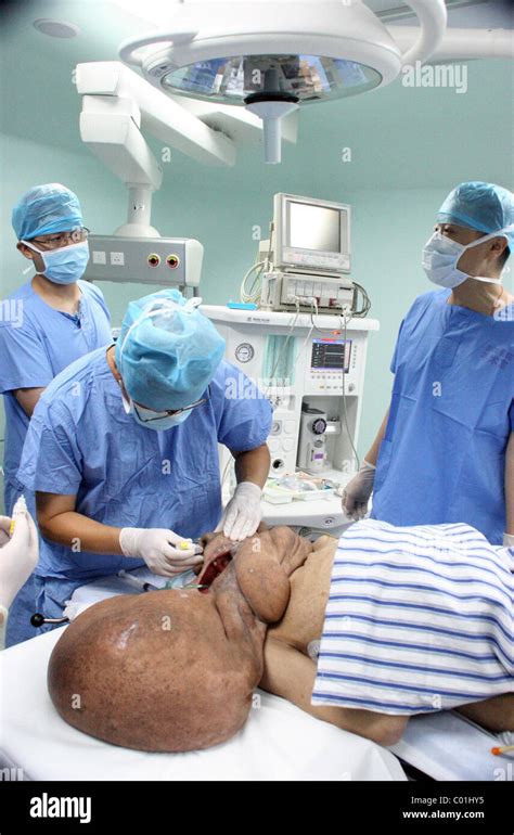 Chinese Elephant Man Surgery A Success A Chinese Patient Dubbed The Elephant Man Has