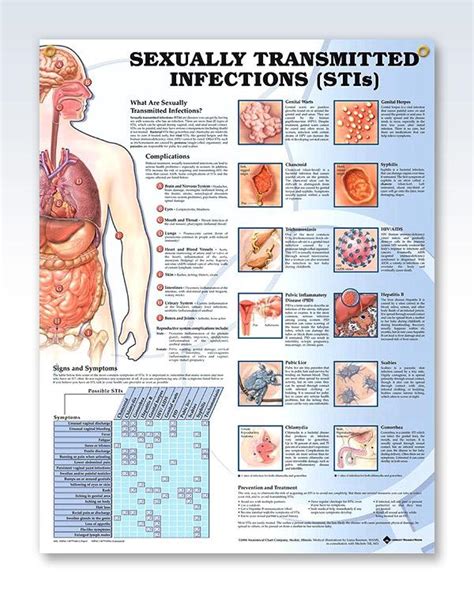 Sexually Transmitted Infections Chart 20x26 Sexually Transmitted