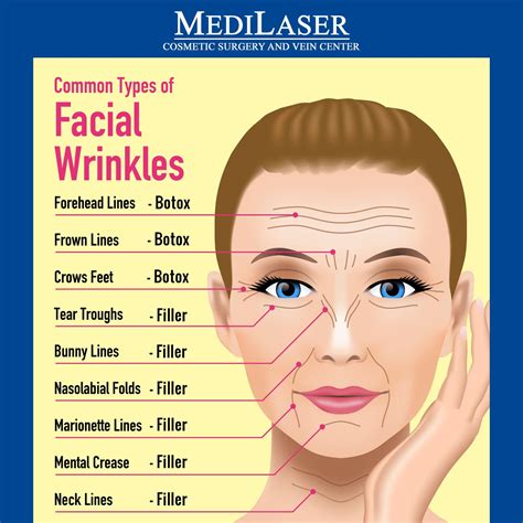 Botox Fillers Dermal Fillers Lip Fillers Facial Wrinkles Forehead