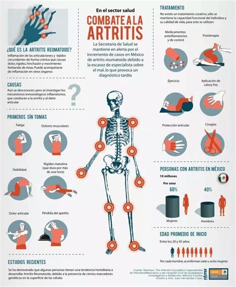 Combate la artritis Infografía articulaciones huesos dolor