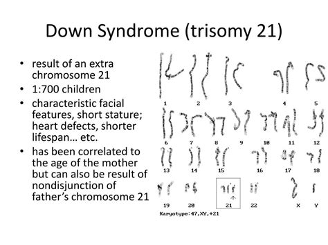 Ppt Down Syndrome Trisomy 21 Powerpoint Presentation Free