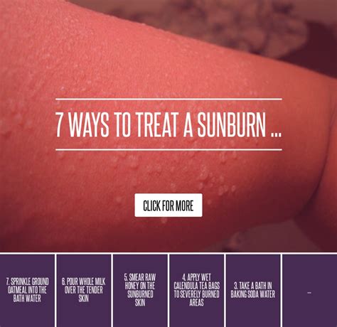 7 Ways To Treat A Sunburn Skincare