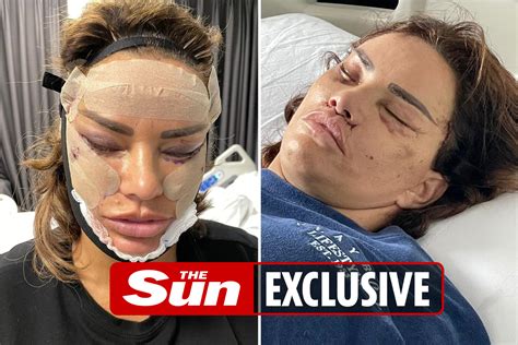 Katie Price Unrecognisable In Shocking Surgery Pictures After Brazilian Bum Lift Liposuction