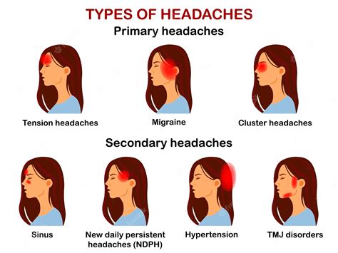 tipos de dores de cabeça infográfico vetorial vetor premium