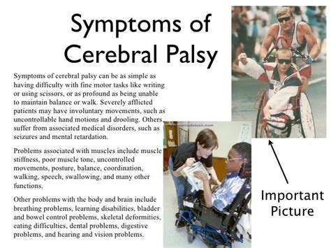 New Treatments And Therapies For Children With Cerebral Palsy Ucsf