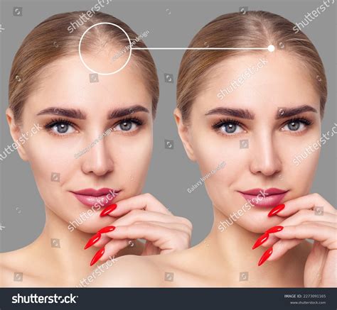 Beautiful Woman Before After Hair Treatment Stock Photo 2273091165