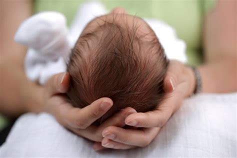 Kepala Bayi Peyang Segera Atasi Dengan 5 Cara Ini