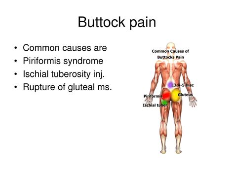 Ppt Back Pain And Treatment Modalities Powerpoint Presentation Id1285291