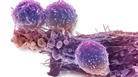 Gene Editing Boosts Cancer Killing Cells Bbc News