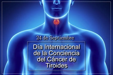 Día Internacional De La Conciencia Del Cáncer De Tiroides Notiexpos Y Congresos