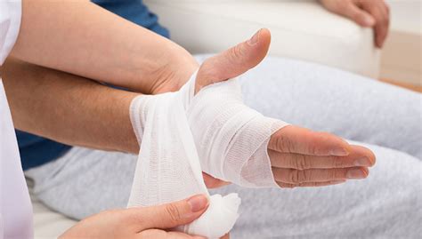 La frattura delle dita della mano - Centro Fisioterapia Roma