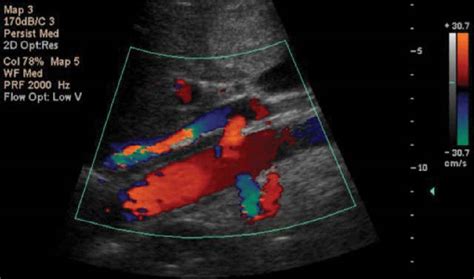 Abdominal Vascular Sonography Lange Review Ultrasonography