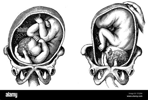 Womb Illustration Black And White Stock Photos And Images Alamy