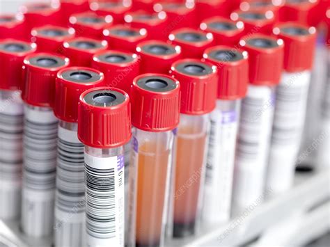 Blood Samples Stock Image C0010764 Science Photo Library