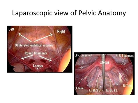 Female Pelvic Anatomy Laparoscopic