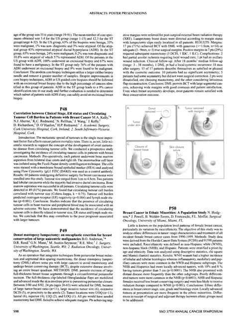 Pdf Donut Mastopexy Lumpectomy An Oncoplastic Resection For Breast