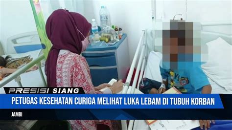 Bocah 8 Tahun Disiksa Ibu Tiri Selama 1 Tahun Video Dailymotion