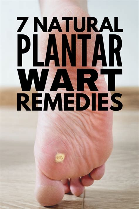 Home Remedies That Work 7 Natural Treatments For Plantar Warts