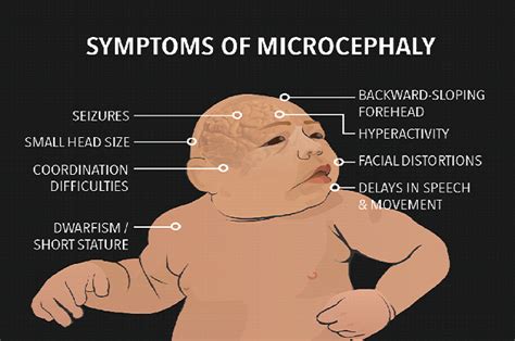 Have A Glance Of Zika Virus Symptoms And Treatment Get Life Tips