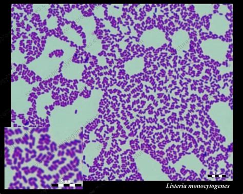 Gram stain of listeria monocytogenes (source). Susceptibility of Listeria monocytogenes to antibiotics ...